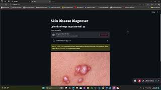 Skin Diseases Diagnoses AI [upl. by Krissie]