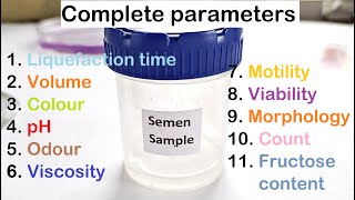 Semen Analysis Test Lab  Complete Video [upl. by Gentry981]