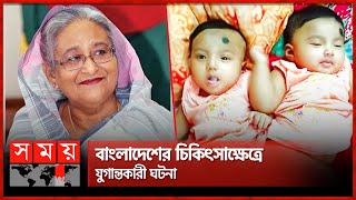 প্রধানমন্ত্রীর খরচে মেরুদণ্ড জোড়া লাগানো শিশুরা আলাদা  Conjoined twin separation  PM Sheikh Hasina [upl. by Lowe]