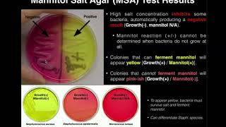 Mannitol Salt Agar MSA  Results amp Theory [upl. by Barlow]