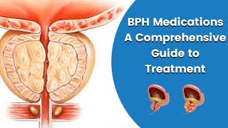 BPH Medications A Comprehensive Guide to Treatment [upl. by Acebber]