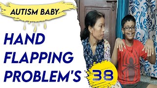 Hand Flapping Autism Baby  How To fix Autism Kids Hand Flapping  Hand Flapping [upl. by Haliled]