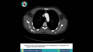 Renal Artery Stenosis [upl. by Hintze763]