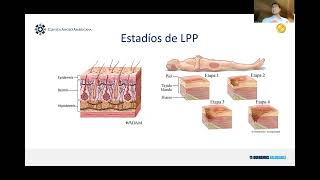 PROGRAMA DE PREVENCION DE LESIONES POR PRESION [upl. by Notnirt]