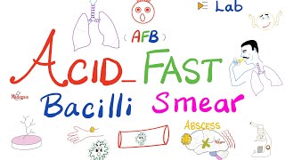 Acid Fast Bacilli Smear AFB smear for tuberculosis TB  Labs 🧪 [upl. by Anibla]