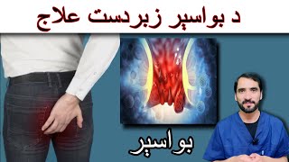 What Is HEMORRHOIDS  Bawaseer [upl. by Jak509]