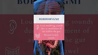 Lets learn bowel sounds together 💩🩺 bowelsounds medstudent medicine [upl. by Eisse]