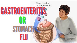 Gastroenteritis or Stomach Flu Causes Symptoms Treatment and Prevention [upl. by Kulseth]