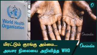 Mpox நோயால் உலக நாடுகளுக்கு ஆபத்து  Oneindia Tamil [upl. by Albertine]