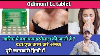 Odimont lc tablet use dose benefits and Side effects full review in hindi [upl. by Noyrb321]