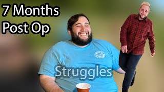 Struggles After Gastric Sleeve  7 Months Post Op Update [upl. by Hsinam]