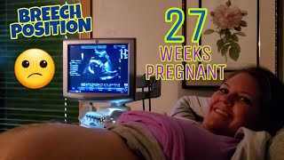 27 WEEKS PREGNANT  BABY IN BREECH POSITION [upl. by Wager]