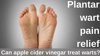 Plantar wart pain relief  Can apple cider vinegar treat warts [upl. by Wallack820]