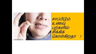 சாப்பிடும் உணவு பற்களில் சிக்கிக் கொள்கிறதா  FOOD LODGEMENT IN TEETH [upl. by Aenil61]