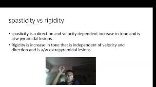 spasticity vs rigidity [upl. by Eaneg]