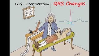 ECG Interpretation QRS Changes Part VI [upl. by Yaned871]