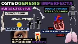 OSTEOGENESIS IMPERFECTA [upl. by Aicnetroh]