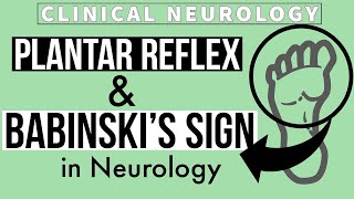 PLANTAR REFLEX  BABINSKIs SIGN  Equivocal Plantar  Other methods  Clinical Neurology [upl. by Carolann]