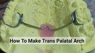 How to Make Transpalatal Arch  TPA orthodontic Appliance By Haider [upl. by Frazer]