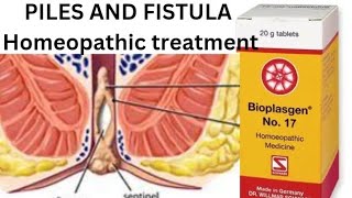 PILESFISTULA Best treatment in homeopathy Fistula problemsAnal FISTULA medicircle7553 [upl. by Nwahsed]