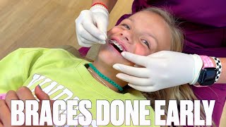 NINE YEAR OLD GETTING BRACES OFF EARLY  HOW TO SHORTEN TIME WITH BRACES [upl. by Antipas]