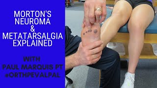 Mortons Neuroma and Metatarsalgia Whats the Difference [upl. by Zinn165]