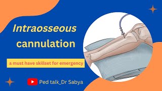 Intraosseous cannulation Putting an IO line Emergency circulatory access Skills in pediatrics [upl. by Alicul]