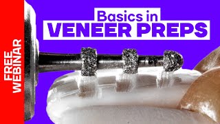 Basic principles in veneer preps FREE Webinar [upl. by Akcimahs]