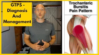 Greater Trochanteric Pain Syndrome Diagnosis and Treatment [upl. by Akitahs]