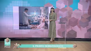 IL PRURITO DERMATOLOGICO [upl. by Aisanat65]