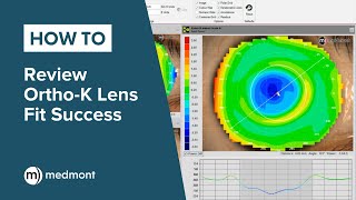 HowTo  Review OrthoK lens fit success [upl. by Burnsed]