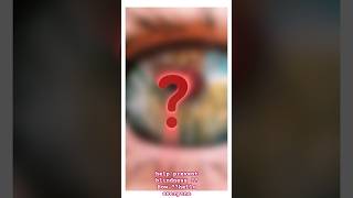 Peripheral Iridotomy In eye optocruisers eyecare optometry ophthalmology viral youtube [upl. by Hsevahb]