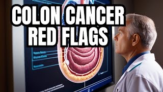 Are you ignoring these 4 warning signs of colon cancer [upl. by Concoff450]