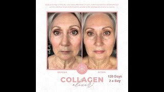 Isagenix Collagen Elixir Progress Photos [upl. by Alyahc]