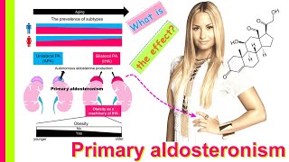 primary aldosteronism [upl. by Eade]