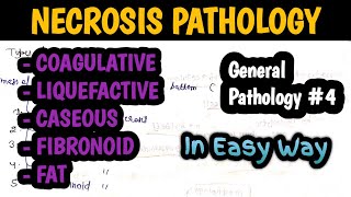 Necrosis Pathology  Types of Necrosis  Cell injury pathology  General Pathology 4 [upl. by Delmer]