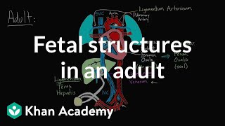 Fetal structures in an adult  Circulatory system physiology  NCLEXRN  Khan Academy [upl. by Adore]