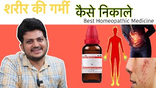 शरीर की गर्मी कैसे निकाले  Body Heat  Acidity  Best Homeopathic Medicine [upl. by Eisdnyl]