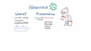 Norovirus  Epidemiology Clinical Presentation and Prevention [upl. by Eindys]