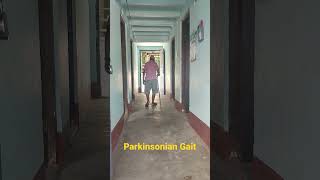 Parkinsonian Gait  Parkinsons Disease [upl. by Siraf494]