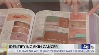 VIDEO How to identify skin cancer [upl. by Garibold]