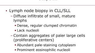 Chapter 28 Mature Lymphoid Neoplasms [upl. by Edelson]