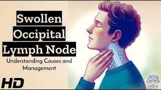 Swollen Occipital Lymph Node Whats Behind It [upl. by Philis]