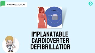 ICD Implantable Cardioverter Defibrillator [upl. by Ayatan334]