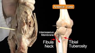 Knee Joint  Anatomy Tutorial [upl. by Nedyrb463]