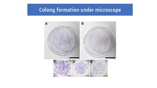 Clonogenic assay [upl. by Stamata583]