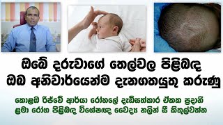 ඔබේ දරුවාගේ තෙල්වල පිළිබඳ ඔබ දැනගතයුතු කරුණු  anterior fontanelle  Dr Nalinckithulwaththa [upl. by Eelinej]