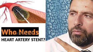 Who Really Needs a Heart Artery Stent [upl. by Oinota]