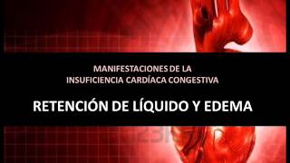 Insuficiencia cardíaca congestiva  Edema y retención de líquido [upl. by Ki975]