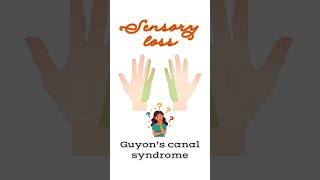 Sensory loss due to Guyon’s canal syndrome shorts ulnarnerve clinicalanatomy [upl. by Annohsak]